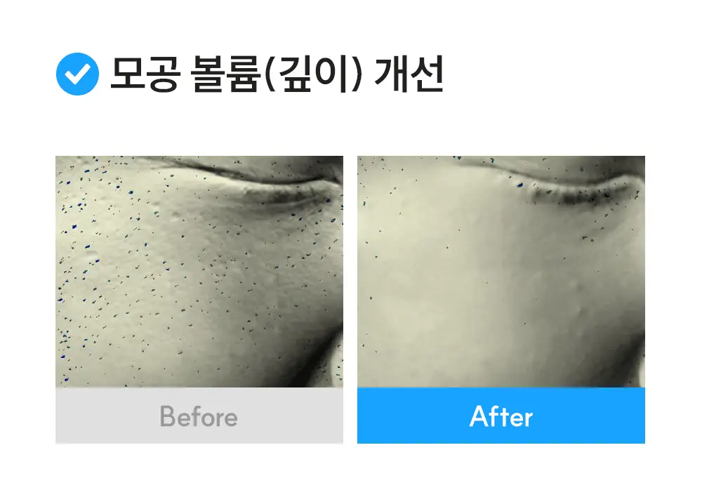 [썸머기프트/1등 화잘먹물먹세럼] 에스네이처 아쿠아 스쿠알란 세럼 50ml 기획(+50ml 리필+수분크림 10ml) 상세페이지 22